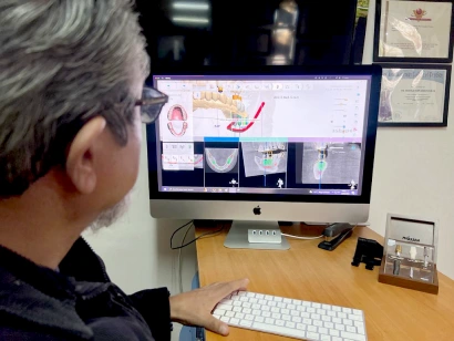 Planeación digital 3D para colocación de implantes guiados en clínica dental Smile & life®